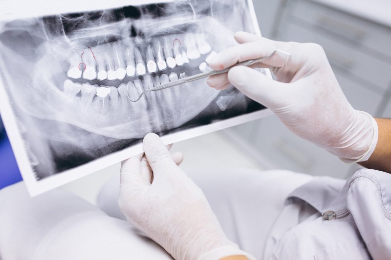 Dentista revisando radiografía de dientes