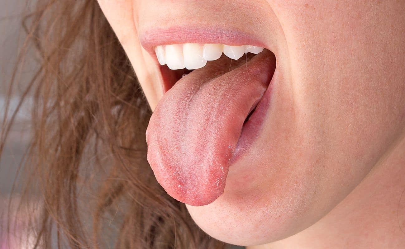 limpieza de la lengua periodoncia e implantes monterrey