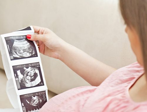 mujer embarazada revisando ecografia periodoncia e implantes monterrey