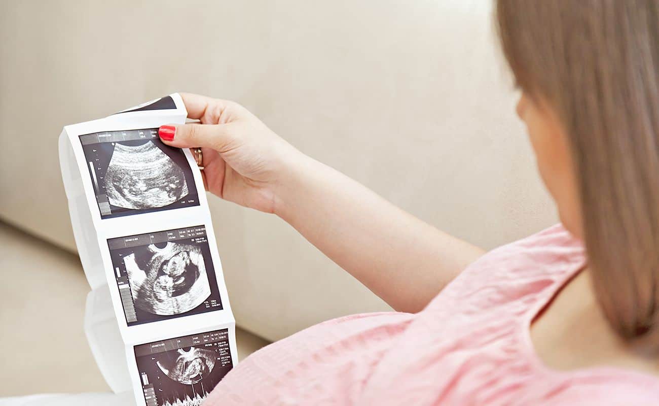 mujer embarazada revisando ecografia periodoncia e implantes monterrey
