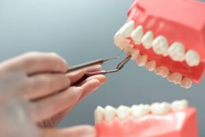 Dentista practicando la cura de la periodoncia con una mandíbula con dientes sintética