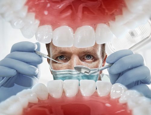 vista de dentadura de adentro hacia afuera con dentista periodoncia e implantes monterrey